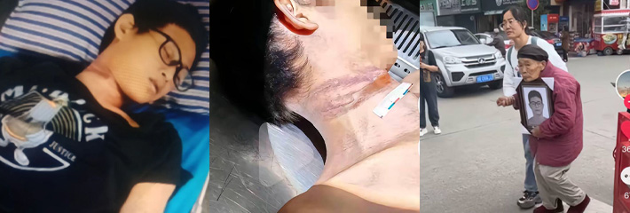 南充建兴中学悲剧：男孩遭校园霸凌自杀 校方处理不当引发社会愤怒 呼吁追求公正！