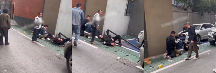 江西一老城区内发生车祸，一男子小腿被撞，转了180度，场面比较血腥，慎点！