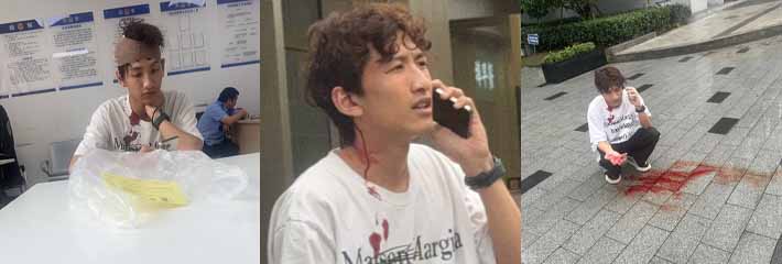 杭州丑逼网络乞丐男模江江 典型狗皮膏药 线下被女生开瓢 鲜血直流！