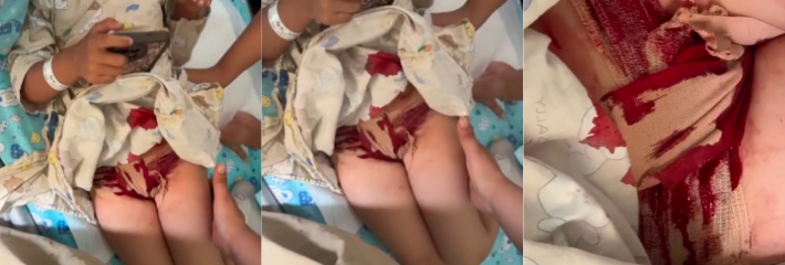东方美育幼儿园女童会 阴撕裂事件 园方洗衣推责疑似隐瞒虐童 家长愤怒曝光引全网热议！