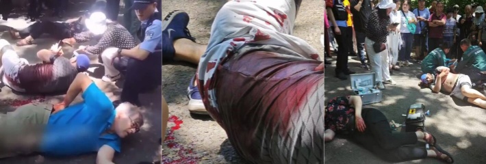 据美联社等西方媒体报道 昨日4名美国大学交换教师在吉林北山公园被刺伤！