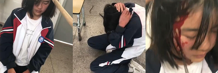 云南玉溪十一中 霸凌再次上演 少女遭女校霸棍棒敲打 头破血流 曝光这些畜生霸凌者！