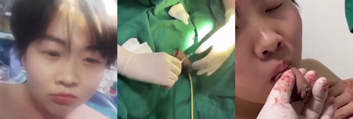 21世纪最后的太监 小伙子在家自己割包皮 下手过重连根拔起 谁说男人没有共情能力的！