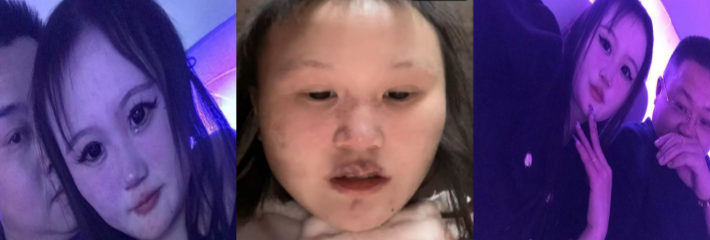 避雷！成都“生化母体”吴思婷惊爆丑闻 隐瞒性病四处约炮 多名男子中招 模样吓人似生化人！