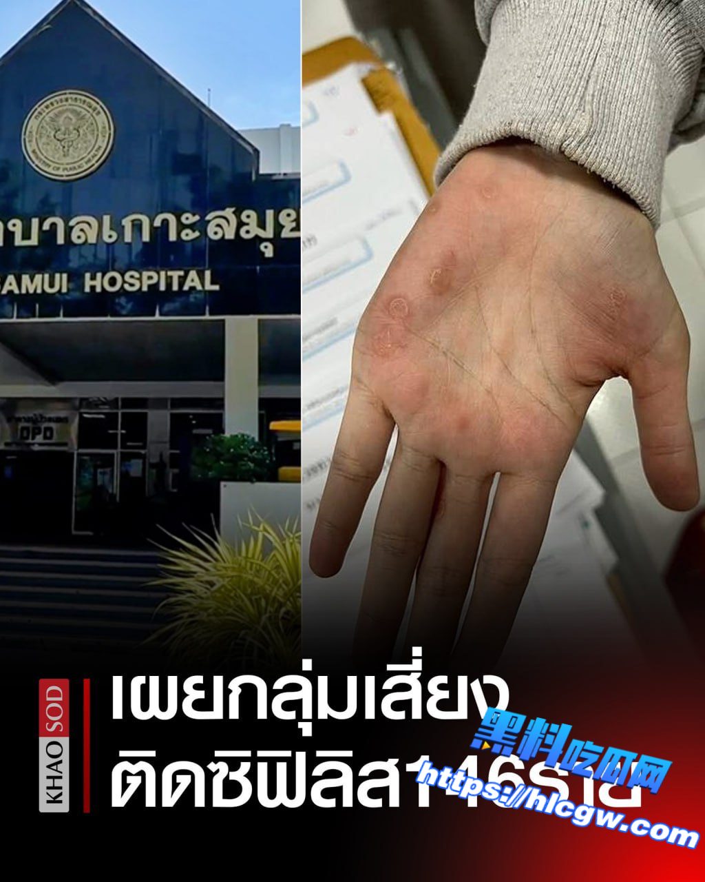 泰国新闻：外国人居多！泰国苏梅岛“梅毒”感染情况令人担忧！
