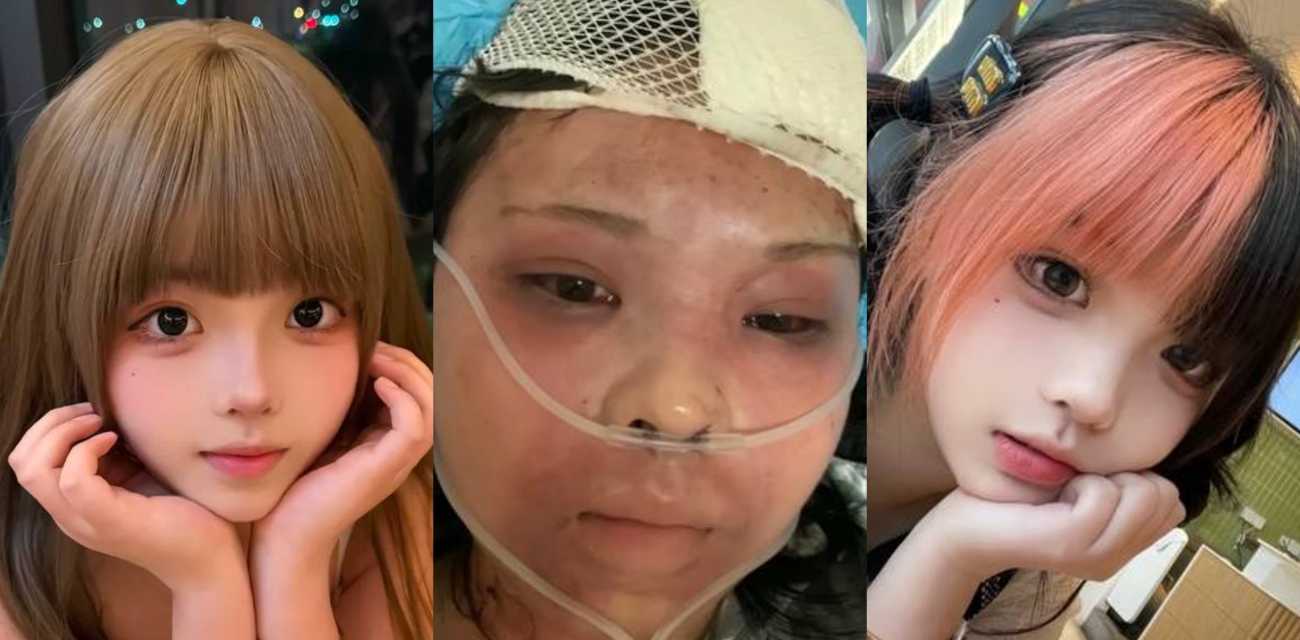 抖音网红 六月欣 8月16日在绍兴柯桥蓝天广场某娱乐场所公厕内遭陌生男子尾随袭击 直接被暴打成猪头！