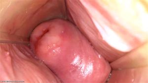Inside Moon: Closeup, Speculum & Cervix Porn - 经典欧美