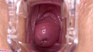 Inside Sydney: Chaturbate, Masturbation & Speculum Cervix Porn - 经典欧美