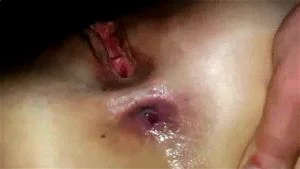 The kind of electroshock therapy a girl can enjoy: Doggy, Missonary & Ass Porn - 经典欧美