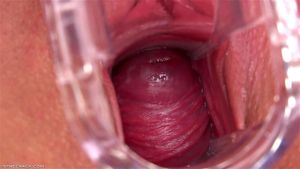Outdoor Gyno ft. Amirah Adara: Closeup, Speculum & Cervix Porn - 经典欧美