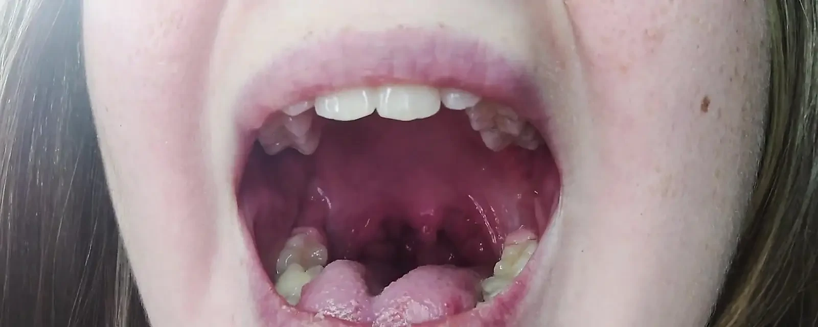 喉咙恋物癖