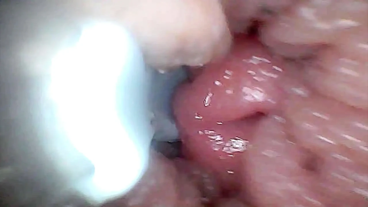G点刺激和高潮内镜视角的视觉指南