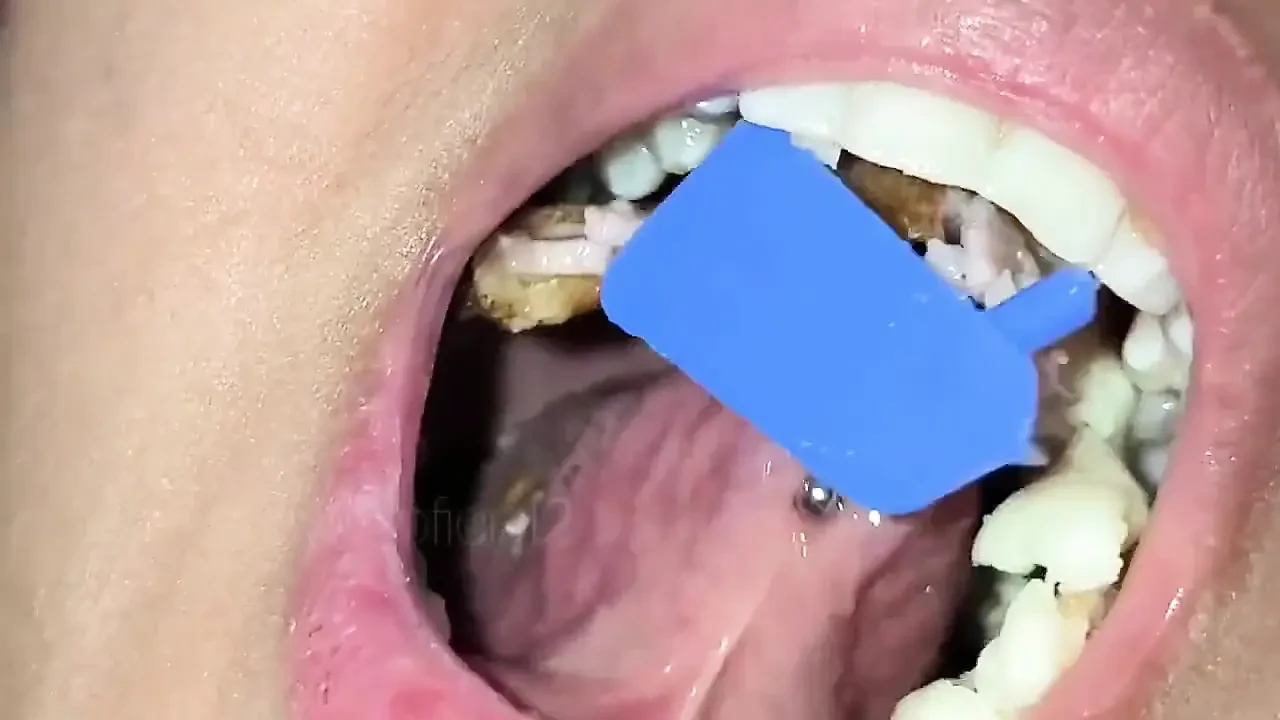 巨人, 小男人今天早上是我的早餐