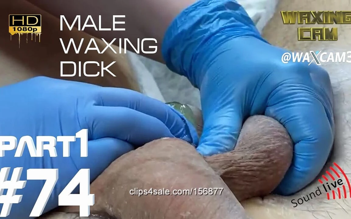 #74-1 男性脱毛