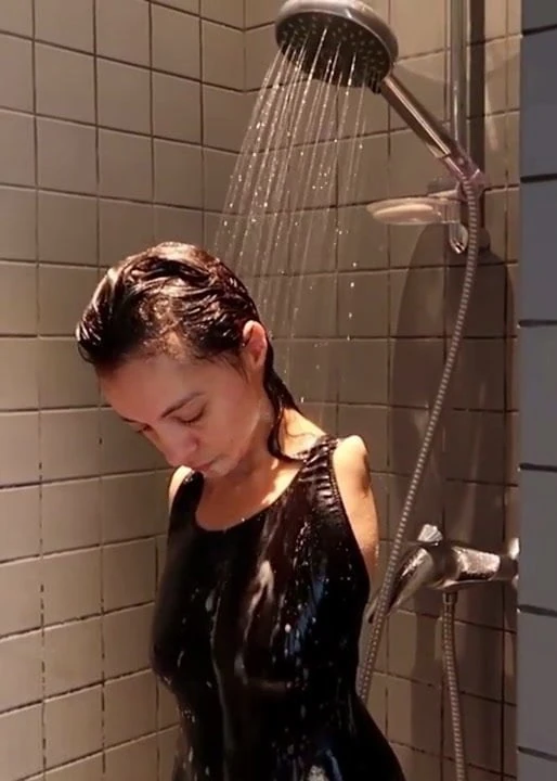 截肢者