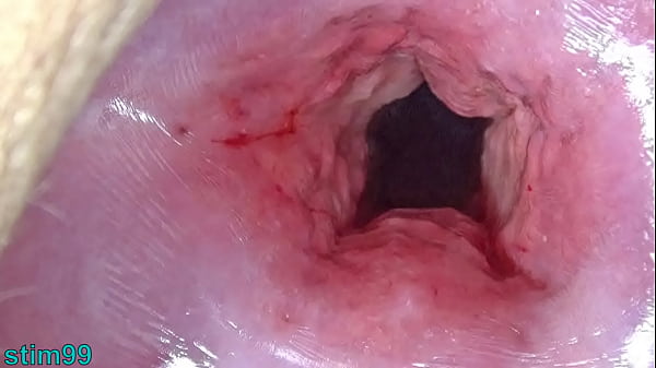 japan_mom_cervix_open_wide_dilatation_and_fucking_uterus_with_insertion_of_huge_objects